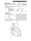 SYSTEM AND METHOD FOR POSITIONING IMPLANTABLE MEDICAL DEVICES WITHIN CORONARY VEINS diagram and image