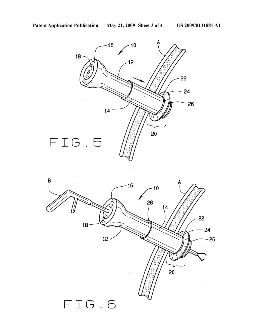 CANNULA - diagram, schematic, and image 04