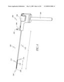 STEERABLE VERTEBROPLASTY SYSTEM diagram and image