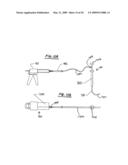 STEERABLE VERTEBROPLASTY SYSTEM diagram and image