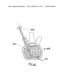 STEERABLE VERTEBROPLASTY SYSTEM diagram and image