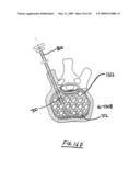 STEERABLE VERTEBROPLASTY SYSTEM diagram and image