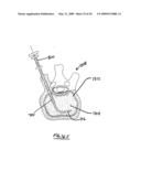 STEERABLE VERTEBROPLASTY SYSTEM diagram and image