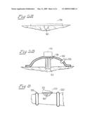 Electrochemical Negative Pressure Wound Therapy Device diagram and image