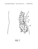 DEVICES AND METHODS FOR DELIVERING DRUG DEPOTS TO A SITE BENEATH THE SKIN diagram and image