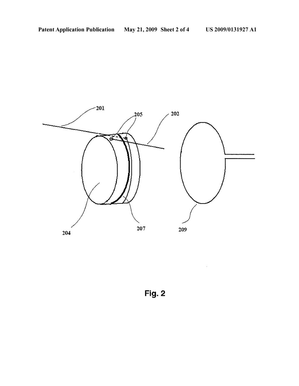 METHOD AND APPARATUS FOR REMOTE DETECTION OF RF ABLATION - diagram, schematic, and image 03