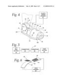 Method of preparing a patient s leg in need of treatment, for ambulation diagram and image