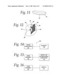 Method of preparing a patient s leg in need of treatment, for ambulation diagram and image