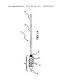 SYSTEM AND METHOD FOR THE FIXATION OF BONE FRACTURES diagram and image