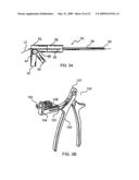 SYSTEM AND METHOD FOR THE FIXATION OF BONE FRACTURES diagram and image