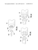 EMBOLUS BLOOD CLOT FILTER AND DELIVERY SYSTEM diagram and image