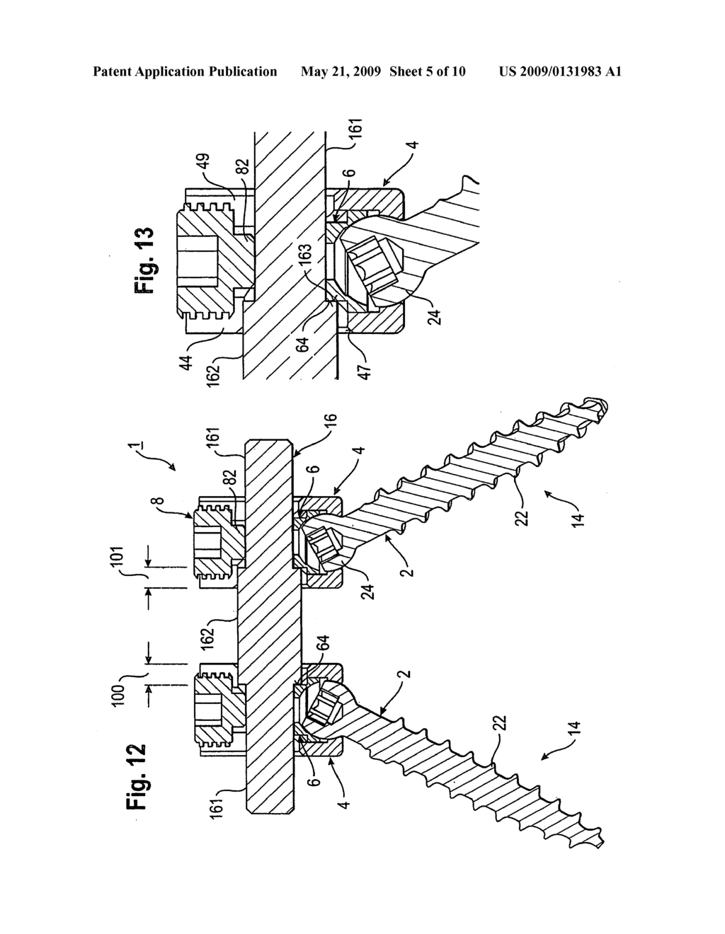 BONE ANCHORING DEVICE AND BONE STABILIZATION DEVICE INCLUDING THE SAME - diagram, schematic, and image 06