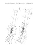 BONE REDUCTION DEVICE AND METHOD UTILIZING SAME diagram and image