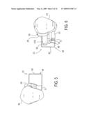 BONE REDUCTION DEVICE AND METHOD UTILIZING SAME diagram and image