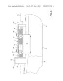 BONE REDUCTION DEVICE AND METHOD UTILIZING SAME diagram and image