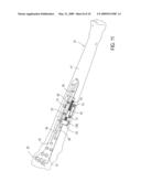 BONE REDUCTION DEVICE AND METHOD UTILIZING SAME diagram and image