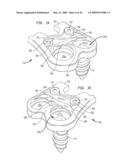 Cervical plate with a feedback device for selective association with bone screw blocking mechanism diagram and image