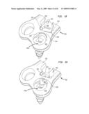 Cervical plate with a feedback device for selective association with bone screw blocking mechanism diagram and image