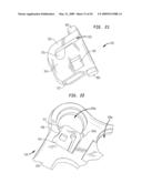 Cervical plate with a feedback device for selective association with bone screw blocking mechanism diagram and image