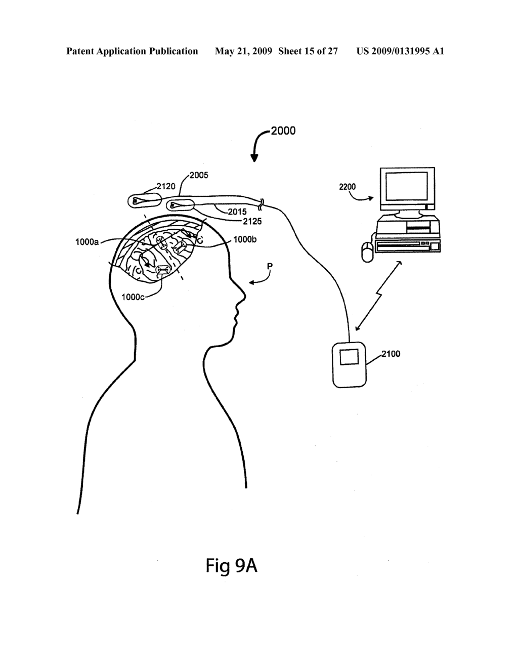 MICRODEVICE-BASED ELECTRODE ASSEMBLIES AND ASSOCIATED NEURAL STIMULATION SYSTEMS, DEVICES, AND METHODS - diagram, schematic, and image 16