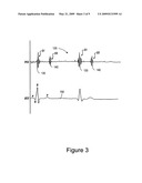 Hemodynamic status assessment during tachycardia diagram and image