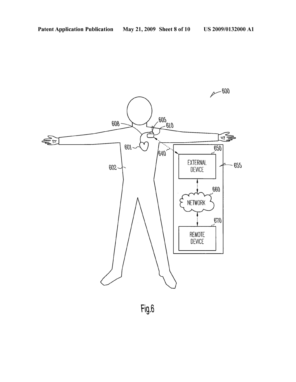 Method and apparatus for monitoring heart failure patients with cardiopulmonary comorbidities - diagram, schematic, and image 09