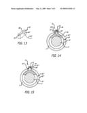 SECUREMENT ASSEMBLY AND METHOD FOR EXPANDABLE ENDOVASCULAR DEVICE diagram and image