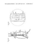 DELIVERY SYSTEM AND METHOD FOR BIFURCATED GRAFT diagram and image