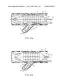 Extendible Stent Apparatus and Method for Deploying the Same diagram and image