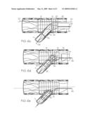 Extendible Stent Apparatus and Method for Deploying the Same diagram and image