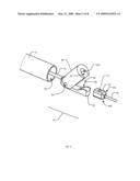 Implant Delivery System and Method diagram and image