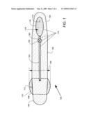 Prosthesis with Bladder that Adjusts Girth diagram and image