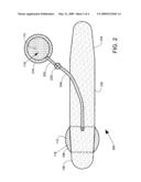 Prosthesis with Bladder that Adjusts Girth diagram and image