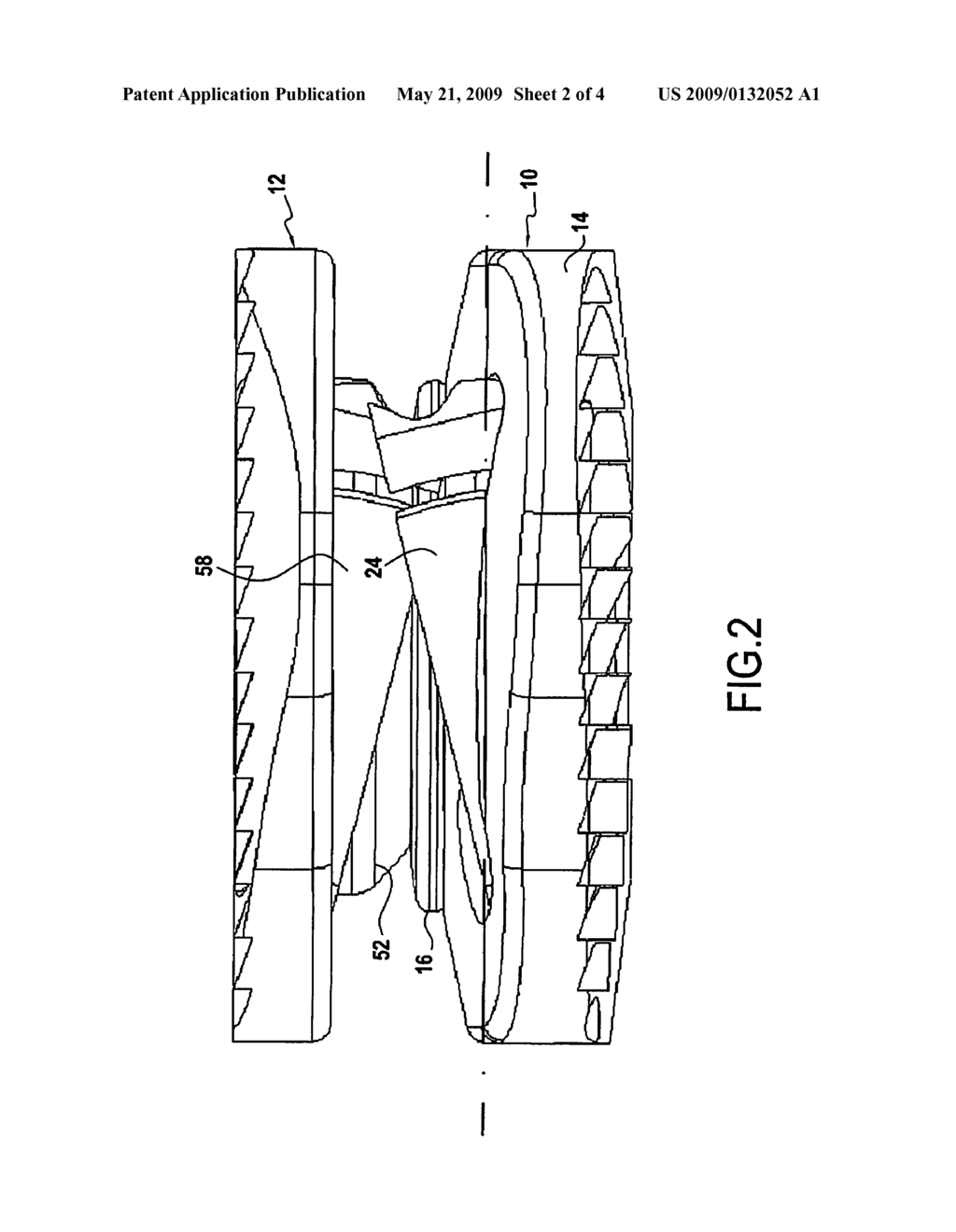 INTERVERTEBRAL DISK PROSTHESIS PROVIDED WITH ANCHOR MEANS - diagram, schematic, and image 03