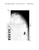 USER INTERFACE FOR ADJUSTING THRESHOLDS AND PRESENTING MAMMOGRAPHY PROCESSING RESULTS diagram and image