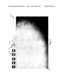 USER INTERFACE FOR ADJUSTING THRESHOLDS AND PRESENTING MAMMOGRAPHY PROCESSING RESULTS diagram and image