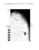 USER INTERFACE FOR ADJUSTING THRESHOLDS AND PRESENTING MAMMOGRAPHY PROCESSING RESULTS diagram and image