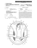 HELMET diagram and image