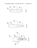 STEM GUIDE AND REPLACEABLE CARTRIDGES diagram and image