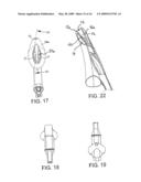 LARYNGEAL MASK AIRWAY DEVICE diagram and image