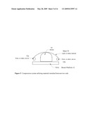 Breast Compression For Digital Mammography, Tomosynthesis And Other Modalities diagram and image