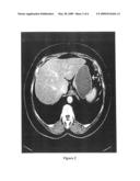 CONTRAST MEDIA FOR USING IN MEDICAL AND DIAGNOSTIC PROCEDURES AND METHODS OF USING THE SAME diagram and image