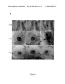 COMPOSITIONS FOR PREVENTING OR TREATING SKIN DEFECTS AND METHODS OF USE THEREOF diagram and image