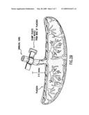 TREATMENT OF PREMATURE BIRTH COMPLICATIONS diagram and image