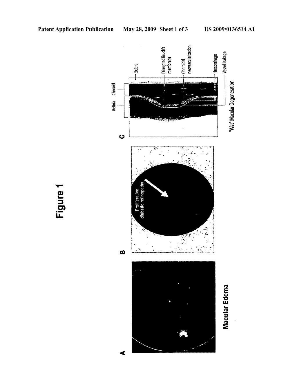 Tetracyclines for Treating Ocular Diseases and Disorders - diagram, schematic, and image 02