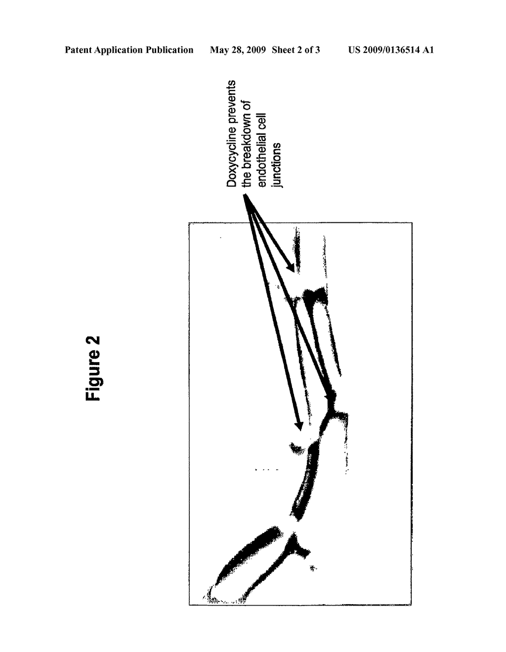 Tetracyclines for Treating Ocular Diseases and Disorders - diagram, schematic, and image 03