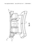 ORTHODONTIC BRACKET INCLUDING MECHANISM FOR REDUCING SLOT WIDTH FOR EARLY TORQUE CONTROL diagram and image