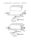 Measuring Apparatus For The Programming And Welding Of Adjustable Brackets diagram and image