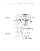 Measuring Apparatus For The Programming And Welding Of Adjustable Brackets diagram and image