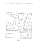 Insert For A Handheld Ultrasound Surgical Device diagram and image